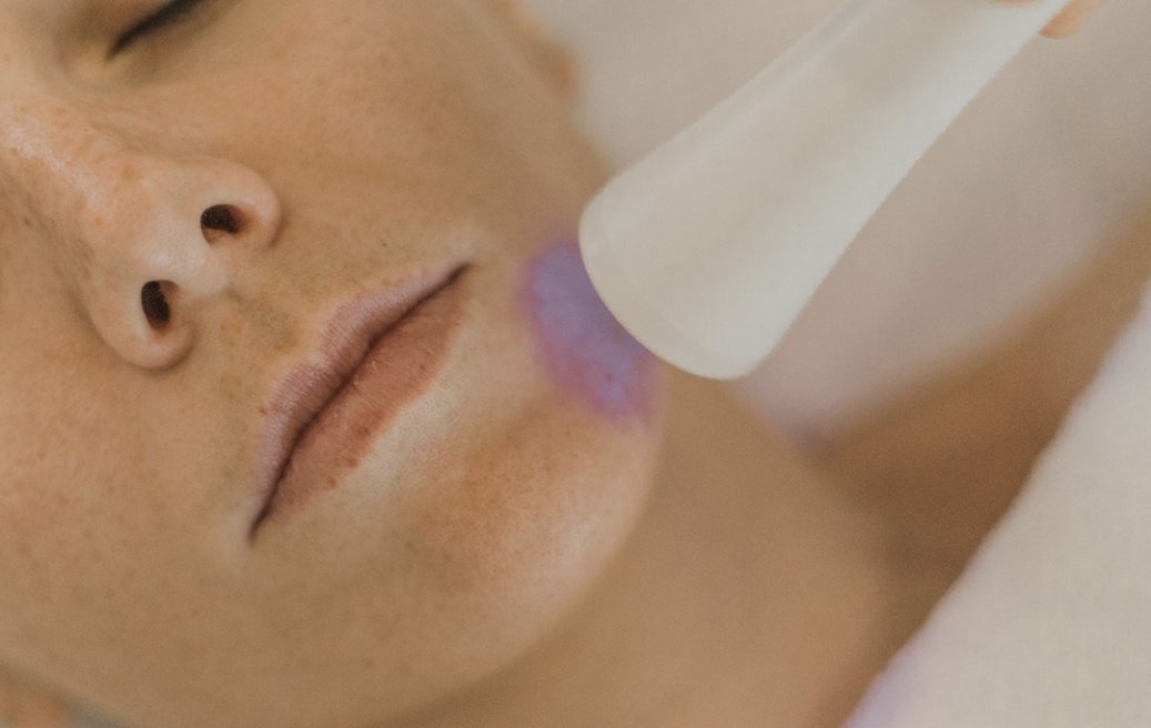 Instant Radiance Package